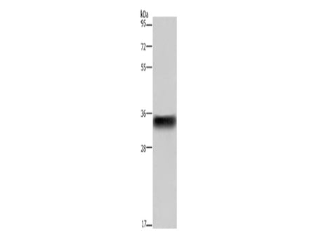 CD32 Polyclonal Antibody Store at -20°C - MSE Supplies LLC