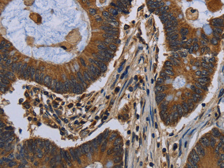 FGF18 Polyclonal Antibody Store at -20°C - MSE Supplies LLC