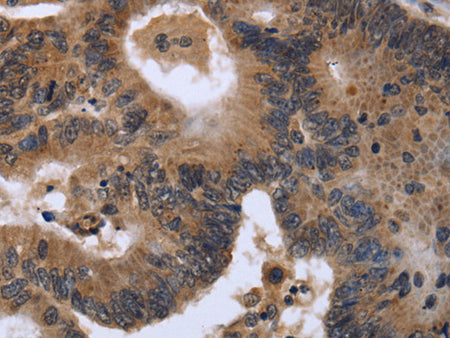 FGF21 Polyclonal Antibody Store at -20°C - MSE Supplies LLC