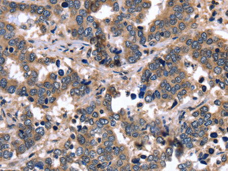 FGFR1OP2 Polyclonal Antibody Store at -20°C - MSE Supplies LLC