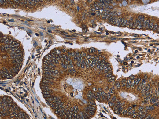 FHIT Polyclonal Antibody Store at -20°C - MSE Supplies LLC