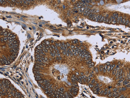 FHIT Polyclonal Antibody Store at -20°C - MSE Supplies LLC