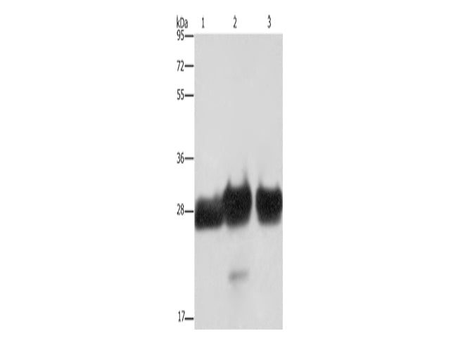 FHL1 Polyclonal Antibody Store at -20°C - MSE Supplies LLC