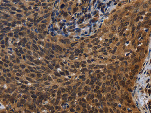 FHL3 Polyclonal Antibody Store at -20°C - MSE Supplies LLC