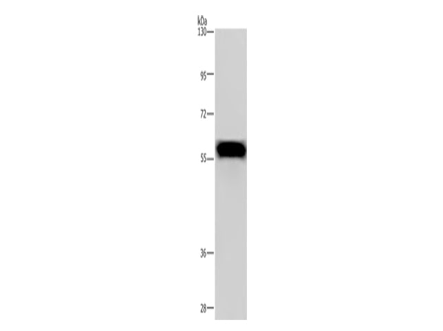 FGB Polyclonal Antibody Store at -20°C - MSE Supplies LLC