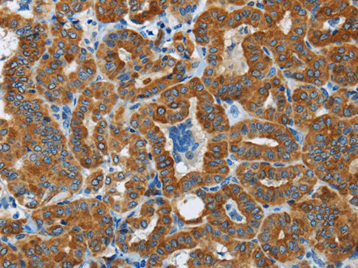 FLCN Polyclonal Antibody Store at -20°C - MSE Supplies LLC