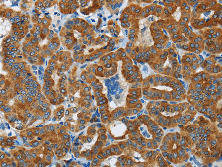 FLCN Polyclonal Antibody Store at -20°C - MSE Supplies LLC