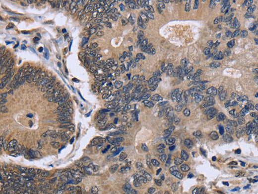 FSTL1 Polyclonal Antibody Store at -20°C - MSE Supplies LLC