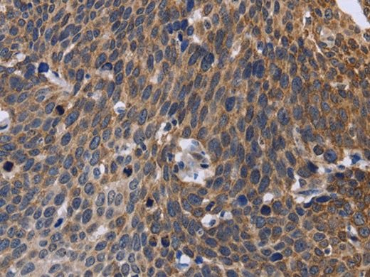 GABPB2 Polyclonal Antibody Store at -20°C - MSE Supplies LLC