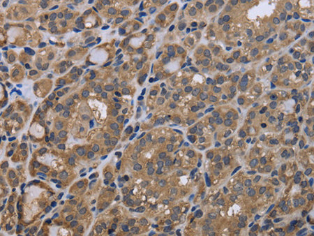 GADD45B Polyclonal Antibody Store at -20°C - MSE Supplies LLC