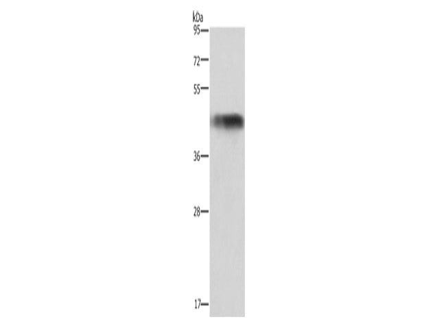 GALT Polyclonal Antibody Store at -20°C - MSE Supplies LLC