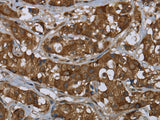 PIP Polyclonal Antibody Store at -20°C - MSE Supplies LLC
