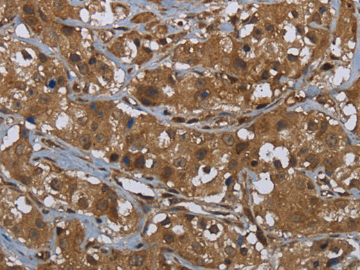GCK Polyclonal Antibody Store at -20°C - MSE Supplies LLC