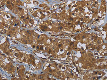 GCK Polyclonal Antibody Store at -20°C - MSE Supplies LLC