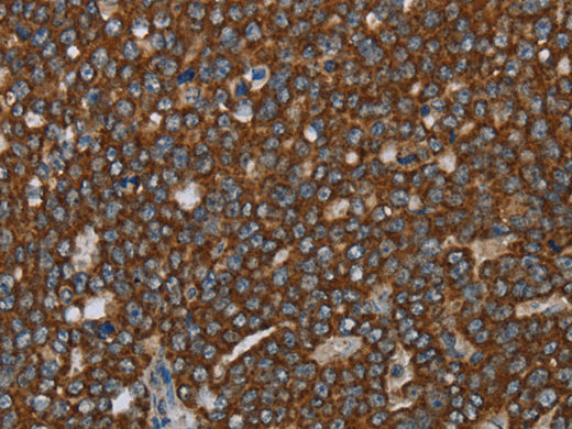 GCKR Polyclonal Antibody Store at -20°C - MSE Supplies LLC