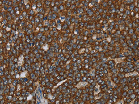GCKR Polyclonal Antibody Store at -20°C - MSE Supplies LLC