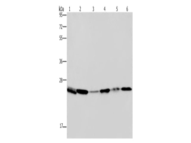 ARHGDIA Polyclonal Antibody Store at -20°C - MSE Supplies LLC