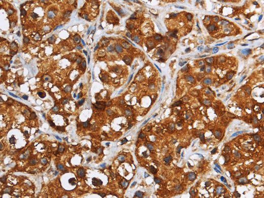 GGCX Polyclonal Antibody Store at -20°C - MSE Supplies LLC