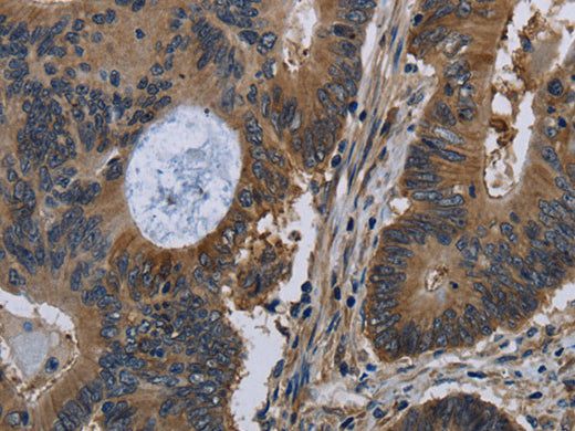 TSC22D3 Polyclonal Antibody Store at -20°C - MSE Supplies LLC