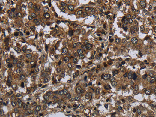 GLIPR1 Polyclonal Antibody Store at -20°C - MSE Supplies LLC