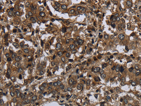 GLIPR1 Polyclonal Antibody Store at -20°C - MSE Supplies LLC