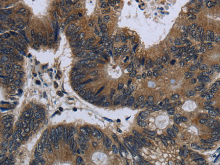 GK1 Polyclonal Antibody Store at -20°C - MSE Supplies LLC