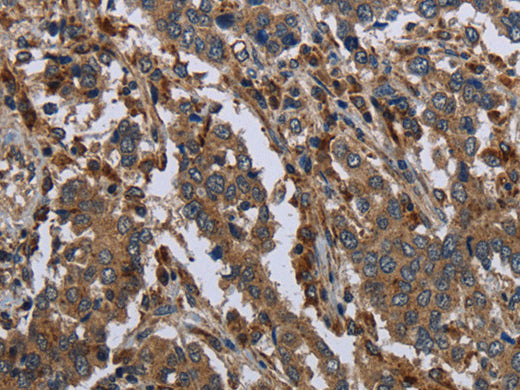 GYS2 Polyclonal Antibody Store at -20°C - MSE Supplies LLC