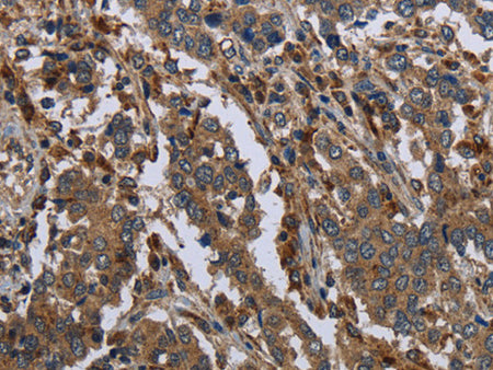 GYS2 Polyclonal Antibody Store at -20°C - MSE Supplies LLC
