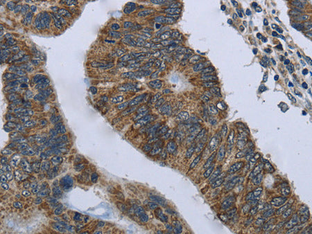 CD236 Polyclonal Antibody Store at -20°C - MSE Supplies LLC