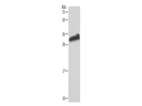 GSTA3 Polyclonal Antibody Store at -20°C - MSE Supplies LLC