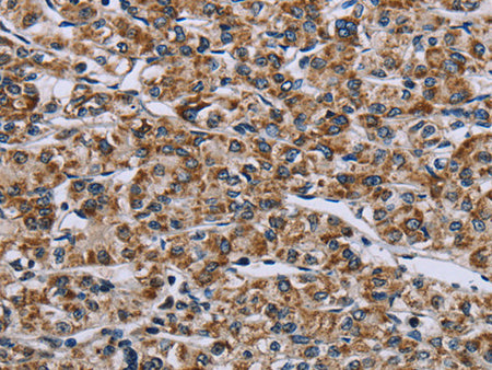 GTPBP10 Polyclonal Antibody Store at -20°C - MSE Supplies LLC