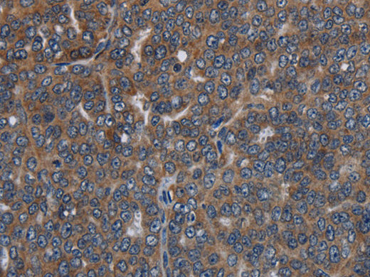 LETMD1 Polyclonal Antibody Store at -20°C - MSE Supplies LLC