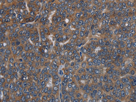 LETMD1 Polyclonal Antibody Store at -20°C - MSE Supplies LLC