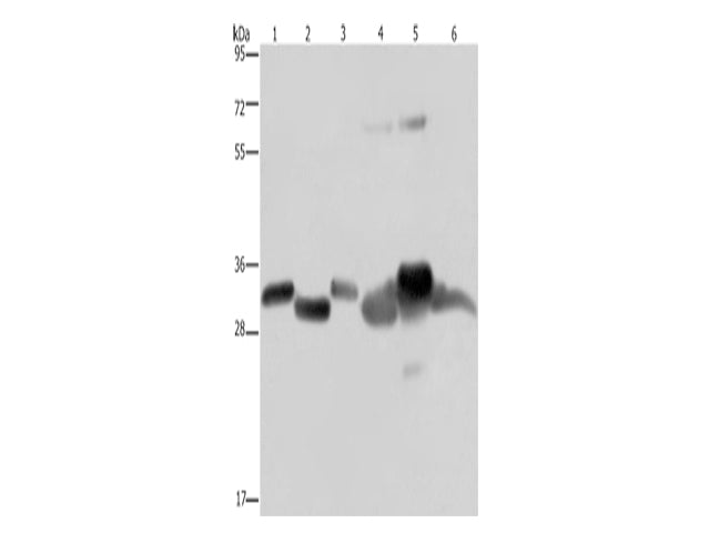 HMGCL Polyclonal Antibody Store at -20°C - MSE Supplies LLC