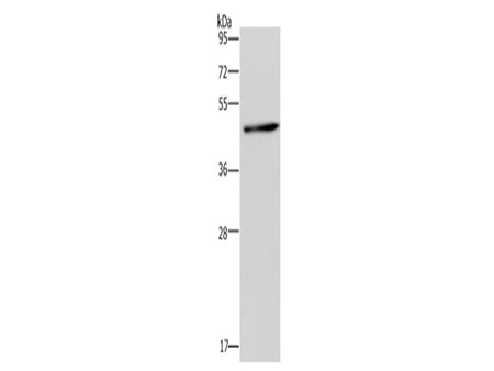 HOMER1 Polyclonal Antibody Store at -20°C - MSE Supplies LLC