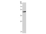 HOMER1 Polyclonal Antibody Store at -20°C - MSE Supplies LLC