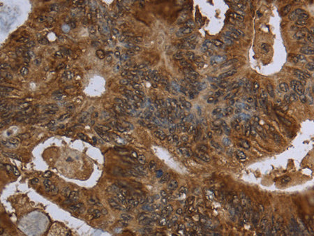 HPGD Polyclonal Antibody Store at -20°C - MSE Supplies LLC