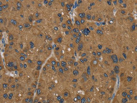 HSD17B2 Polyclonal Antibody Store at -20°C - MSE Supplies LLC
