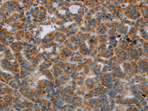 HSD17B14 Polyclonal Antibody Store at -20°C - MSE Supplies LLC