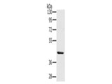 HSD3B7 Polyclonal Antibody Store at -20°C - MSE Supplies LLC
