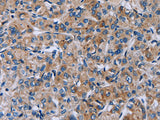 HSD3B2 Polyclonal Antibody Store at -20°C - MSE Supplies LLC