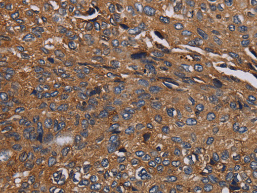 HYAL2 Polyclonal Antibody Store at -20°C - MSE Supplies LLC