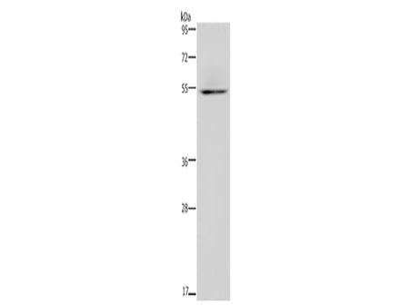 HYAL3 Polyclonal Antibody Store at -20°C - MSE Supplies LLC