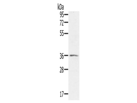 p53RFP Polyclonal Antibody Store at -20°C - MSE Supplies LLC