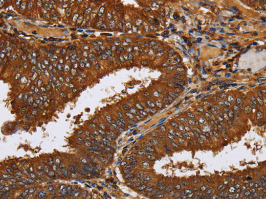 TICAM2 Polyclonal Antibody Store at -20°C - MSE Supplies LLC