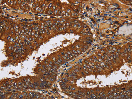 TICAM2 Polyclonal Antibody Store at -20°C - MSE Supplies LLC