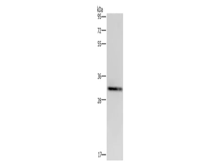 CD242 Polyclonal Antibody Store at -20°C - MSE Supplies LLC