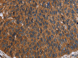 FCGR3A Polyclonal Antibody Store at -20°C - MSE Supplies LLC