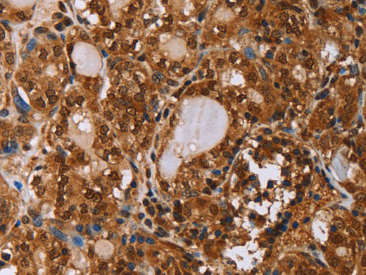 IHH Polyclonal Antibody Store at -20°C - MSE Supplies LLC