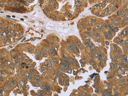 IKBKE Polyclonal Antibody Store at -20°C - MSE Supplies LLC